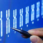 Estudio de microdeleciones del cromosoma Y (Fertilidad Masculina)