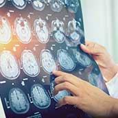 Resonancia Magnética Abierta Cerebral en Madrid  DMI Parla  al precio de 115€