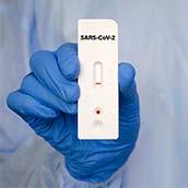 Test rápido de antígenos en Barcelona  Unilabs  al precio de 26€
